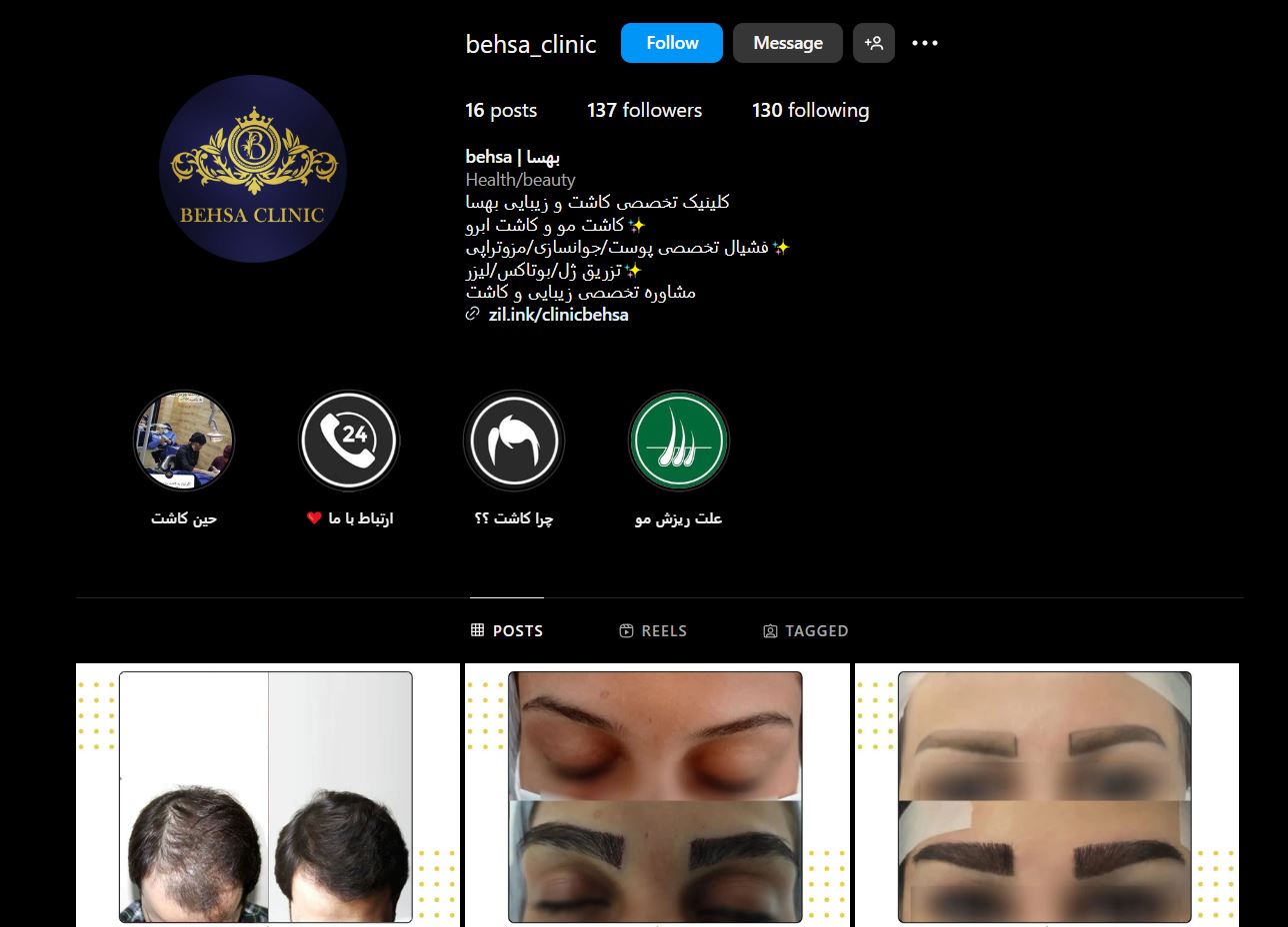 بهترین دکتر تزریق ژل در شیراز کیست؟