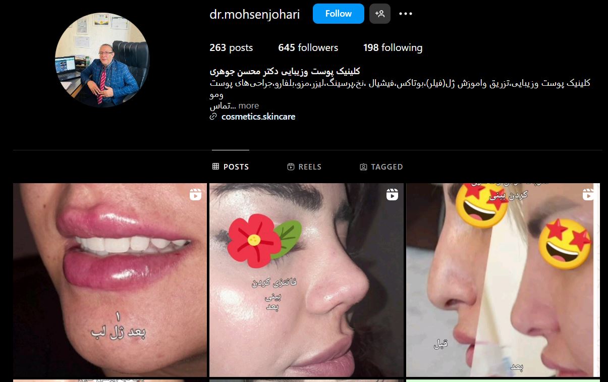 بهترین دکتر تزریق ژل در شیراز کیست؟