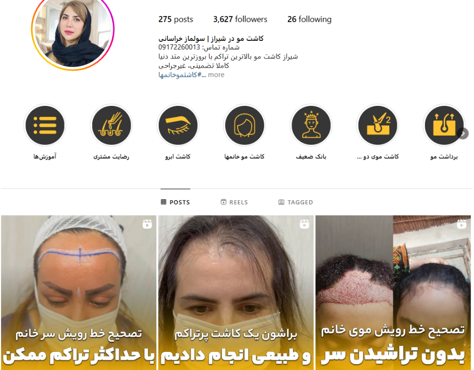 مرکز فوق تخصصی کاشت مو و ابرو شیراز کاشت