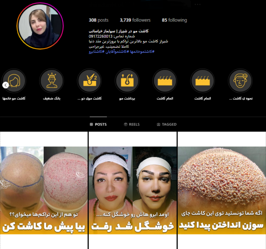 کلینیک شیراز کاشت